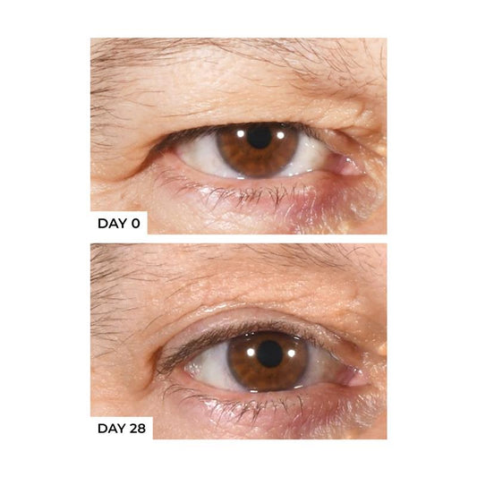 Freezeframe Eyelid Lift 15ml - Anti-Sagging Serum for Youthful Eyes – view 2 - Auzzistore