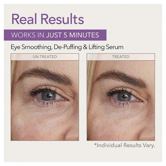 Skin Doctors Instant Eyelift Cream 10ml - Youthful Eye Revitalizer-Auzzi Store