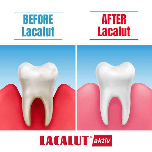 Lacalut Activ Anti-Gingivitis Toothpaste - 6 Tubes x 75ml: Premium Gum Care – view 2 - Auzzistore