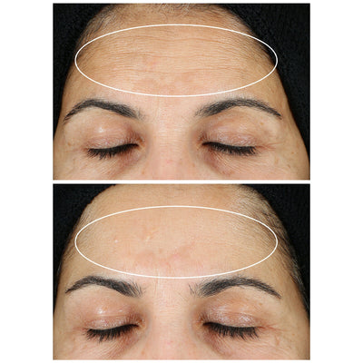 StriVectin Super-C Retinol Brighten And Correct Vitamin C Serum