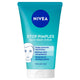 NIVEA Daily Essentials Anti-Pimple Face Scrub 150ml - Blemish Control - Auzzistore