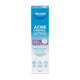 Dermal Therapy Acne Control Lotion 85ml - Daily Oil-Free Moisturizer – view 2 - Auzzistore