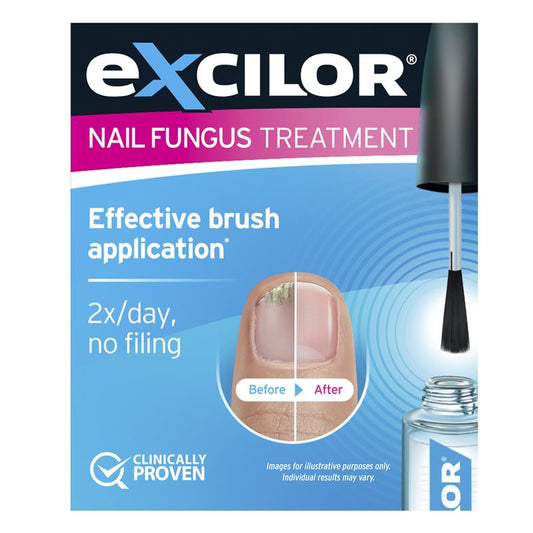 Excilor Fungal Nail Solution 3.3ml - Advanced Treatment for Fungal Nail Infections - Auzzistore
