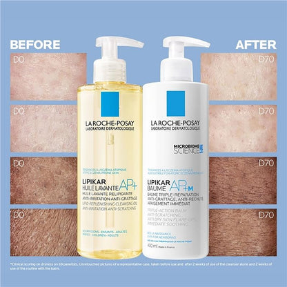 La Roche-Posay Lipikar Baume AP+M Body Balm 400ml - Eczema Relief & Hydration-Auzzi Store