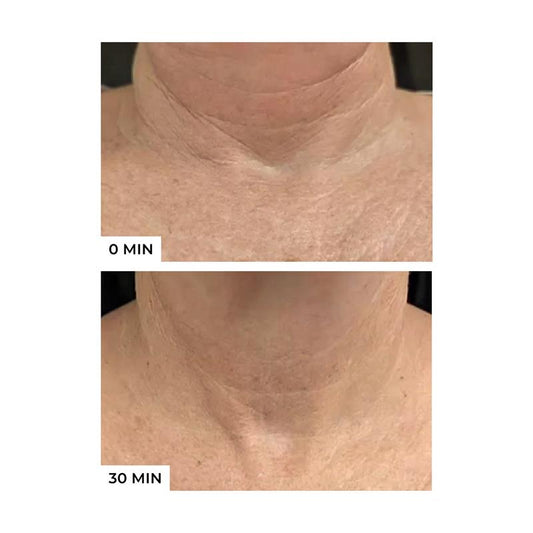 Freezeframe Neck Lift 50ml - Advanced Anti-Aging Treatment – view 2 - Auzzistore