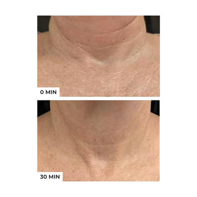 Freezeframe Neck Lift 50ml - Advanced Anti-Aging Treatment