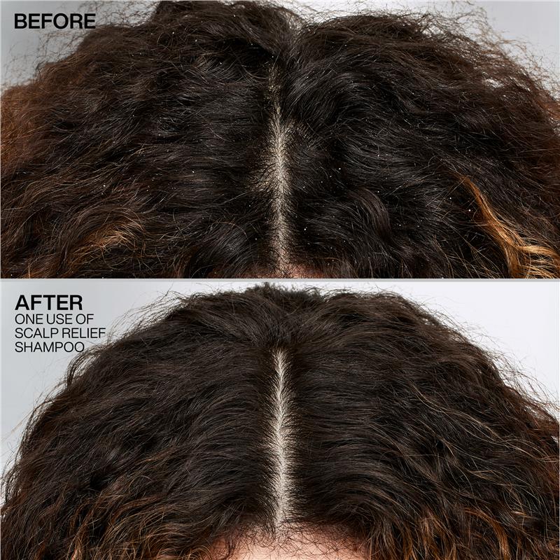 Redken Scalp Relief Dandruff Shampoo 250ml - Control Dandruff Effectively