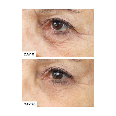 freezeframe REVITALEYES 15ml - Target Deep Wrinkles, Puffiness, and Dark Circles