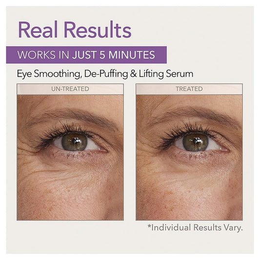 Skin Doctors Instant Eyelift Cream 10ml - Youthful Eye Revitalizer-Auzzi Store