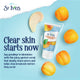 St Ives Blemish Control Scrub Apricot 150ml - Clear Skin Solution – view 3 - Auzzistore