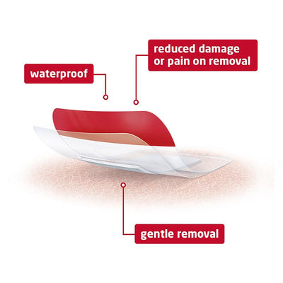 Leukomed T Plus Skin Sensitive Transparent Dressing 5cm x 7.2cm - 5 Pack