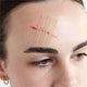 Leukostrip Wound Closure Strips 6.4mm x 76mm - 3 Pack – view 4 - Auzzistore