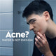 NIVEA MEN Face Wash Deep Rapid Acne Clear 150ml - Target Acne Effectively – view 3