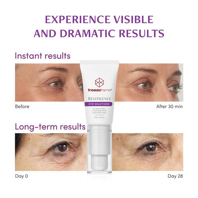 freezeframe REVITALEYES 15ml - Target Deep Wrinkles, Puffiness, and Dark Circles