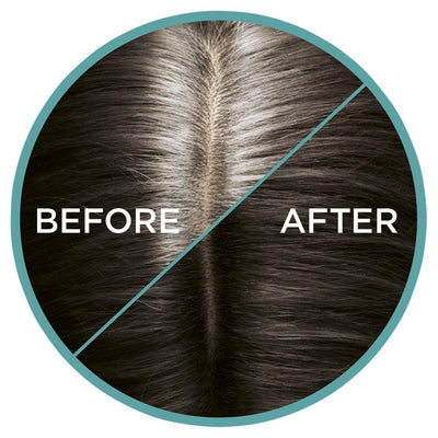 L'Oreal Paris Magic Retouch Temporary Root Concealer Spray - Cool Dark Brown 75ml