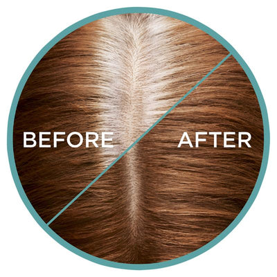 L'Oreal Paris Magic Retouch Temporary Root Concealer Spray - Auburn - 75ml