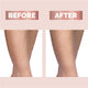 Flawless Finishing Touch Legs Epilator – White, Cordless, LED Light – view 5
