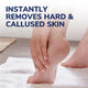 Scholl Callus File – Dual Sided Manual Foot File for Removing Hard Skin – view 4 - Auzzistore