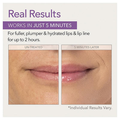 Skin Doctors Instant Lip Plumper 3ml - Fuller, Hydrated Lips