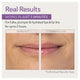 Skin Doctors Instant Lip Plumper 3ml - Fuller, Hydrated Lips – view 4 - Auzzistore