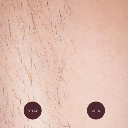 Nad's Sensitive Hair Removal Cream 150ml – Natural Ingredients, PETA Certified