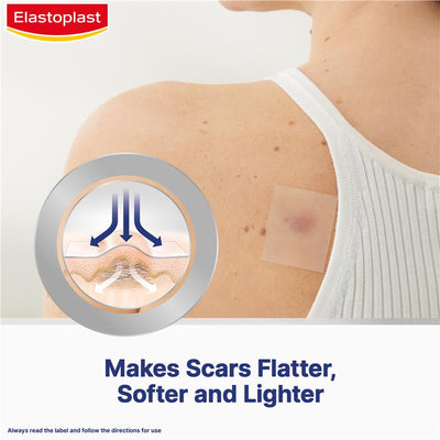 Elastoplast Scar Reducer 21 Patches - Effective Scar Treatment