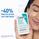 CeraVe Blemish Control Cleanser - 236ml – view 5 - Auzzistore