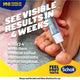 Scholl Fungal Nail Treatment - 3.8ml Effective Nail Care – view 5