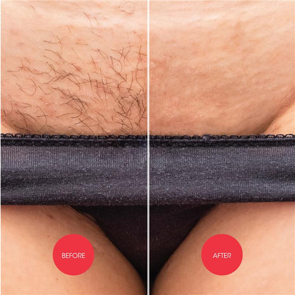 Nads Down Under Hair Removal Cream - 150ml for Gentle Hair Removal