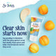 St Ives Blemish Control Scrub Apricot 150ml - Clear Skin Solution – view 5 - Auzzistore