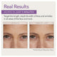 Skin Doctors Instant Wrinkle Filler - 10ml – view 5 - Auzzistore