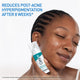 CeraVe Blemish Control Resurfacing Retinol Serum 30ml – view 5 - Auzzistore
