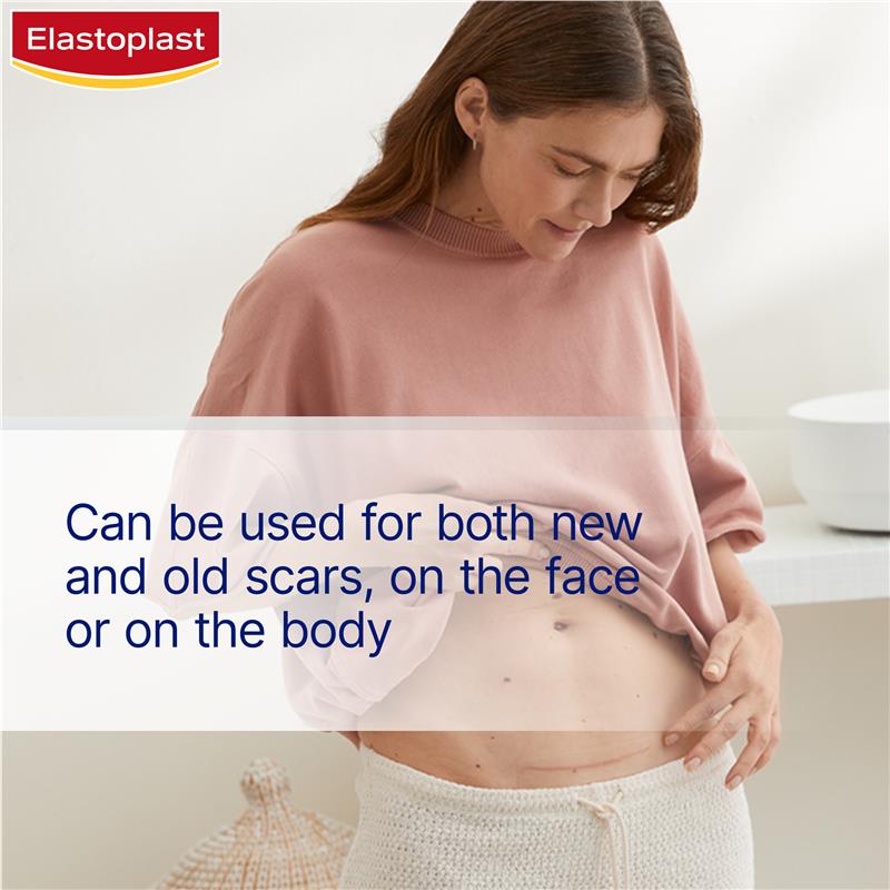Elastoplast Scar Reducer 21 Patches - Effective Scar Treatment