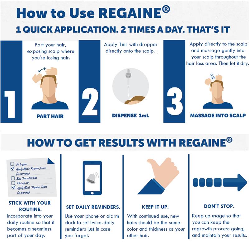 Regaine Men's Extra Strength Minoxidil Hair Regrowth Treatment 4 x 60mL-Auzzi Store