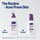 Cetaphil Pro Acne Prone Oil-Free Facial Moisturising Lotion SPF 25 118ml - Hydration & Protection – view 7 - Auzzistore