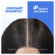 Head & Shoulders Itchy Scalp Care 2in1 Shampoo & Conditioner 350ml - Dual Action Relief – view 8