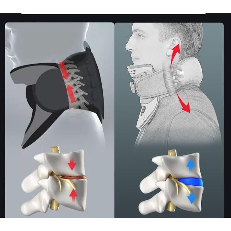 Caremax 3 in 1 Cervical Collar with Air Bag Massage, TENS & Heat - 1 Unit