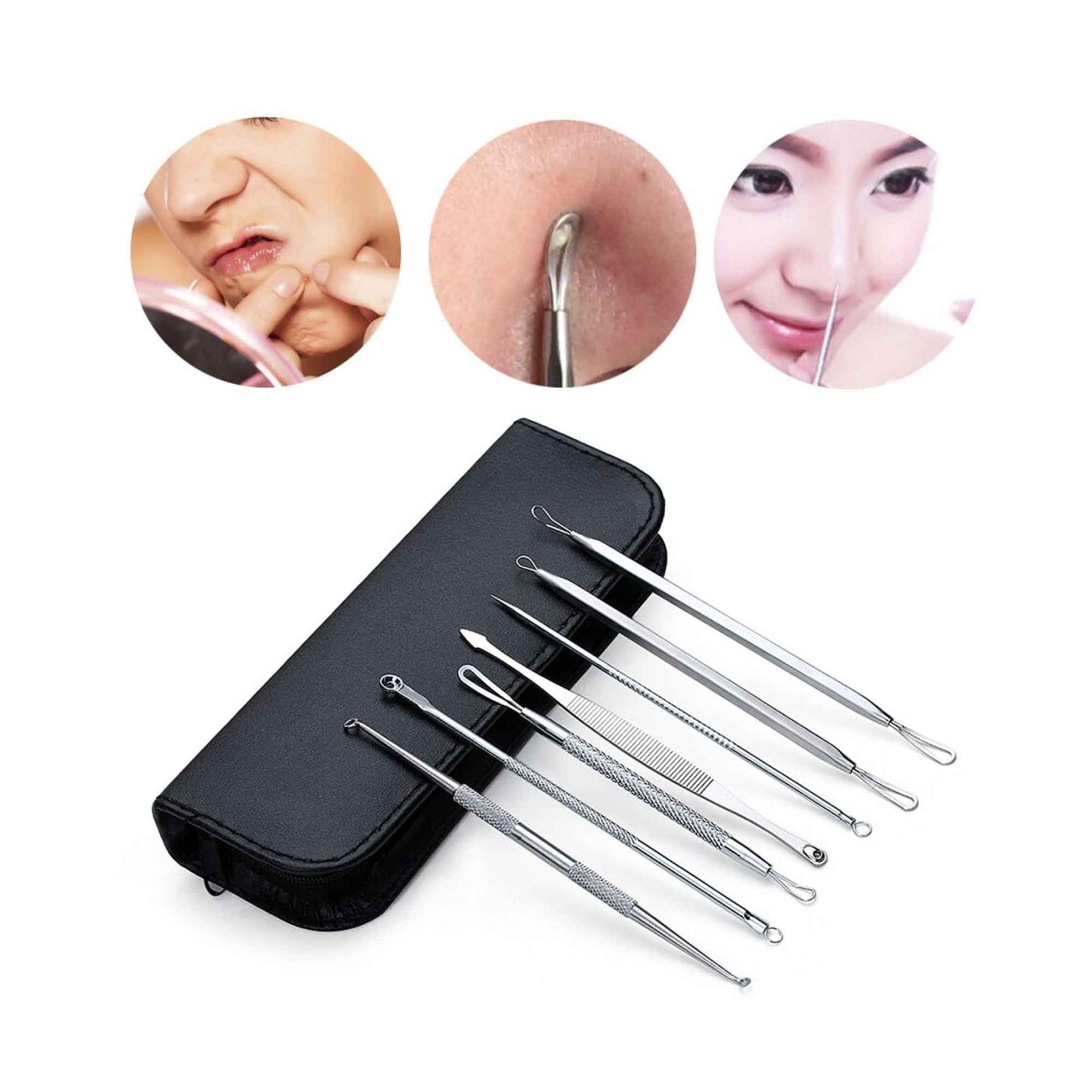 Blackhead Remover 7-Piece Stainless Steel Kit with Leather Case for Acne & Blemish Extraction