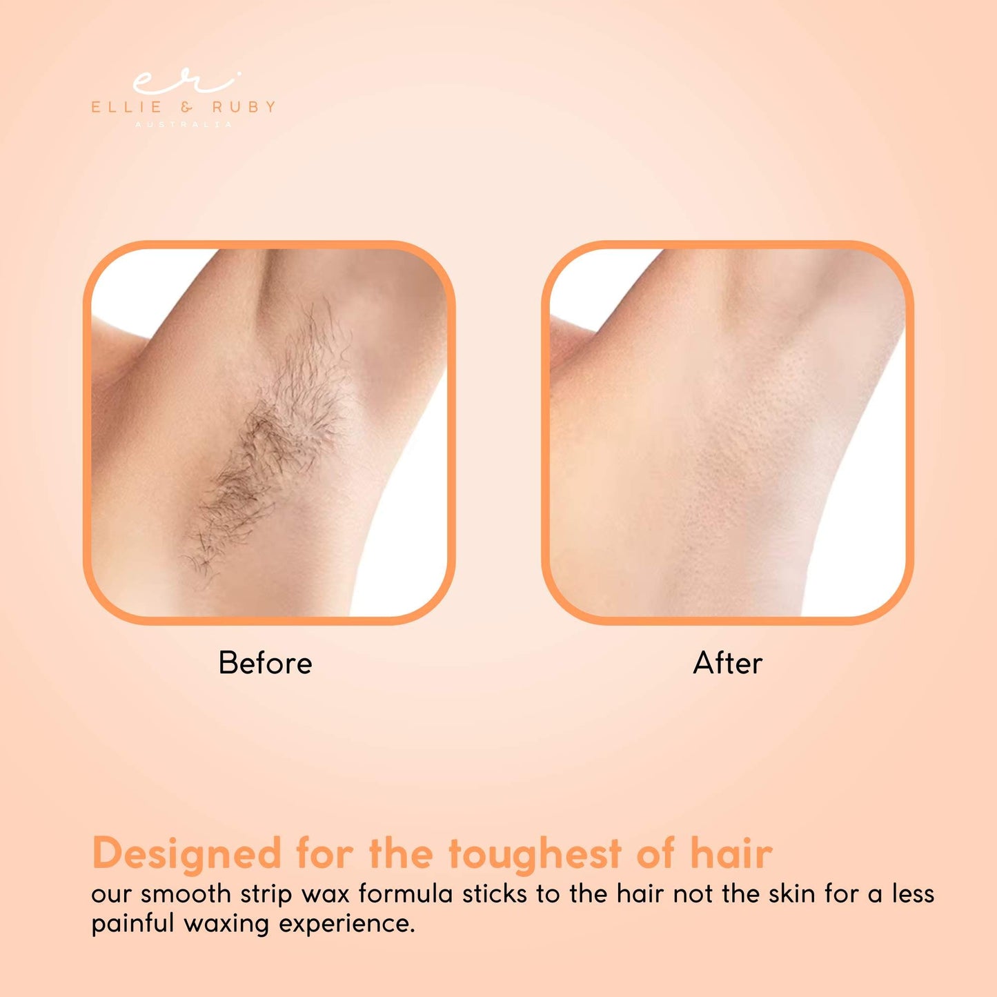 Aloe Vera 400g Soft Wax Hair Removal - Water Soluble, All Skin Types, Resealable Can