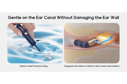 Xiaomi Bebird Earsight Plus Wireless Ear Cleaner