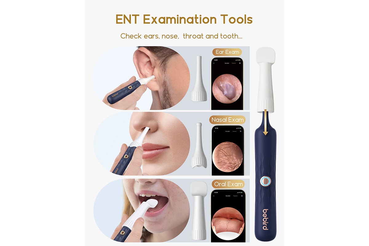 Xiaomi Bebird Earsight Plus Wireless Ear Cleaner