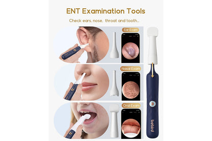 Xiaomi Bebird Earsight Plus Wireless Ear Cleaner