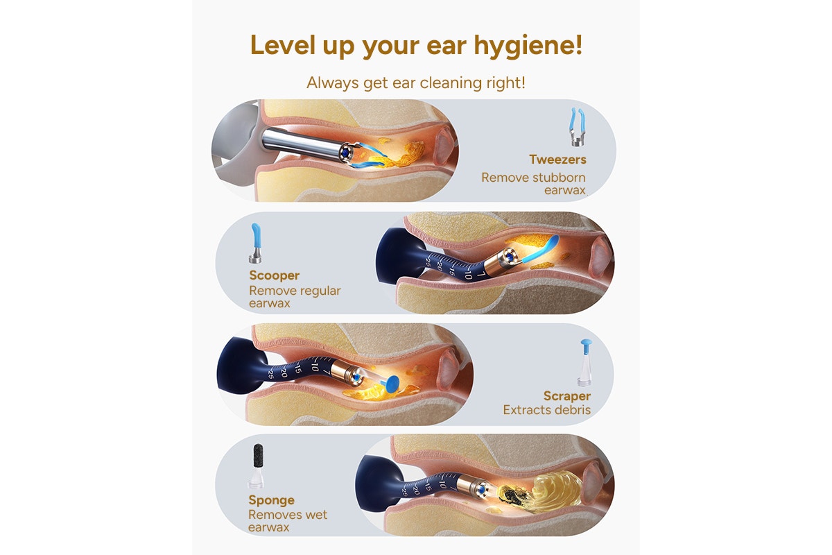 Xiaomi Bebird Earsight Plus Wireless Ear Cleaner