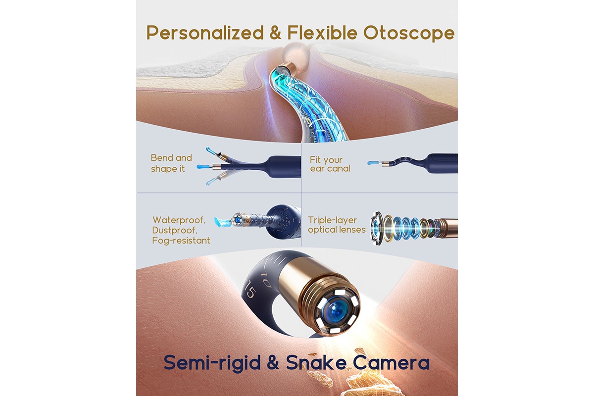 Xiaomi Bebird Earsight Plus Wireless Ear Cleaner