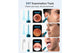 Xiaomi Bebird Earsight Ultra Wireless Ear Cleaner